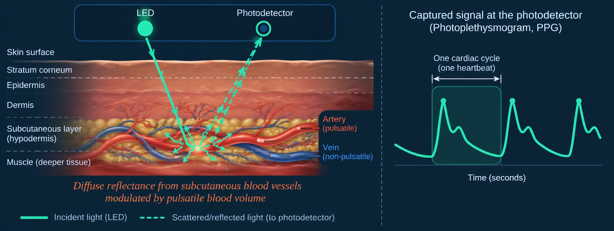 Diagram of reflectance photoplethysmography: light from the watch's LED travels down through the skin layers to the blood vessels, scatters, and part of it returns to the photodetector; the captured signal rises and falls once per heartbeat.